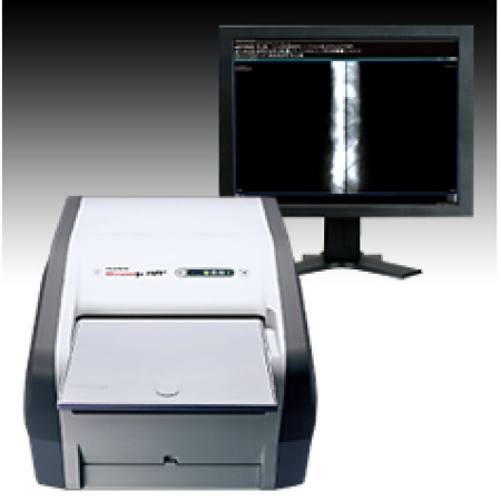 RADIOGRAFIERE DIGITALA COMPUTERIZATA